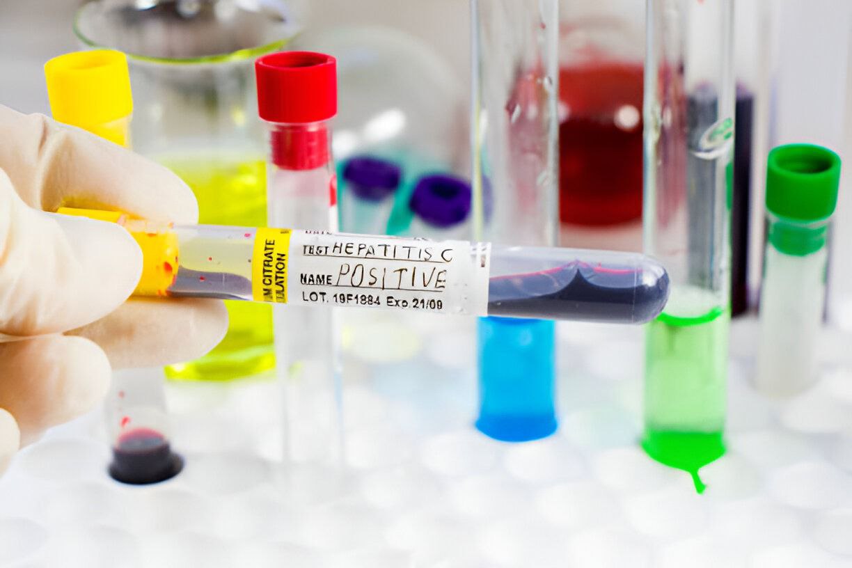 A gloved hand holding a labelled specimen tube among rows of coloured reagent tubes in a laboratory